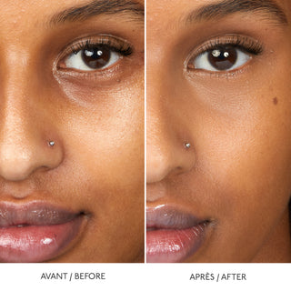 HYALURONIC SERUM CONCEALER