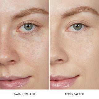 HYALURONIC SERUM CONCEALER