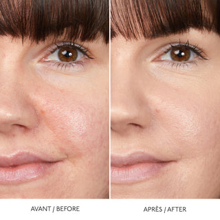 HYALURONIC SERUM CONCEALER