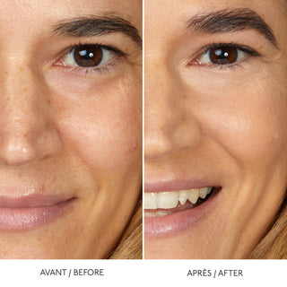 HYALURONIC SERUM CONCEALER