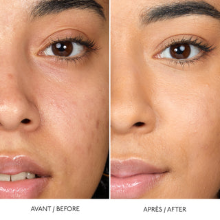 HYALURONIC SERUM CONCEALER